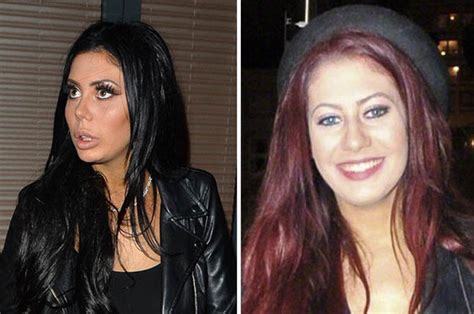 chloe ferry ex|chloe ferry before surgery.